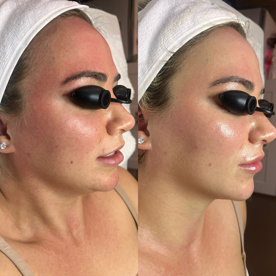 Glow Facials