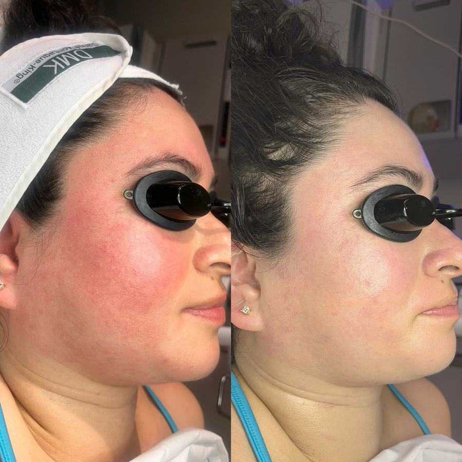 Glow Facials 